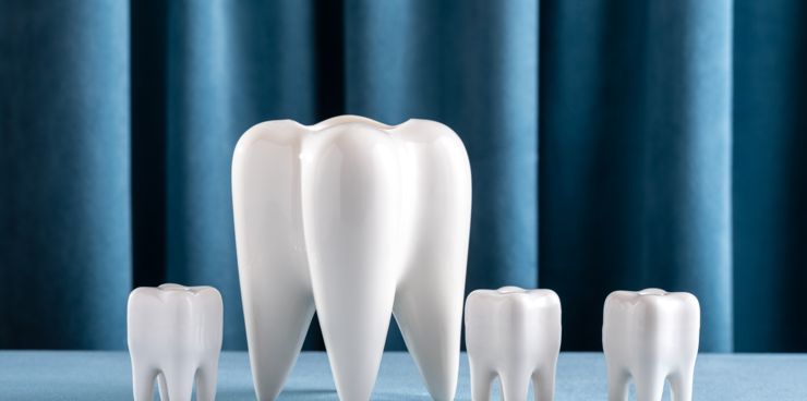Vetrica Clinic Dental Crowns