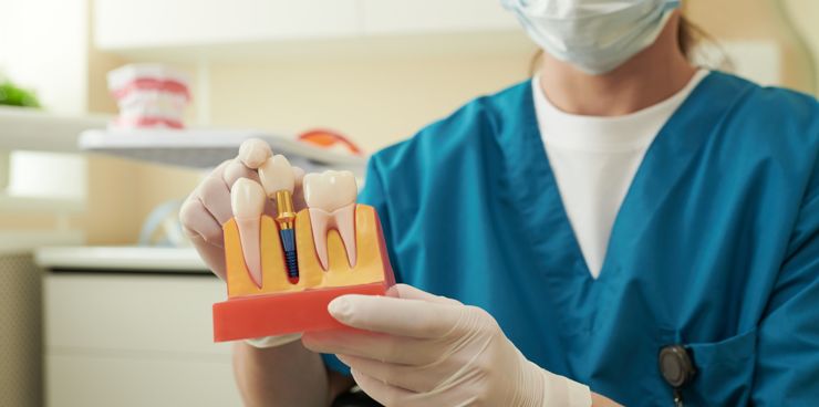 Vetrica Clinic Dental Implants